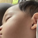 표선의원 | 제주도 여행 중 아기 피부 두드러기 병원 추천 '표선하늘의원' 웨이팅 정보