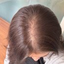 우리연합의원 | 부산탈모병원 부산탈모성지 동래탈모 우리연합의원