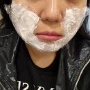 이지한커피 | 강남피부과 슈링크 유니버스 300샷 1달 경과 얼굴형 진짜 달라짐;
