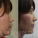 앤써성형외과의원 이미지