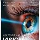 스마일 | 스마일라식 당일 후기 요약정리(정보형)