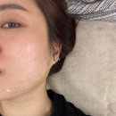 성형안해도청초
