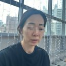 톤즈의원 | 톤즈의원- “볼뉴머 리프팅”후기 , [50대부모님 탄력리프팅,콜라겐리프팅, 고주파리프팅 시술]