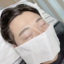 임브로우