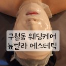 뉴인천 | 인천구월동피부관리 뉴벨라에스테틱 웨딩케어 후기