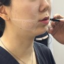 청주프라임병원 | 청주울쎄라 잘하는 곳, 후기보다 중요한 건 따로 있습니다