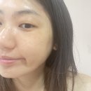 잠실새내피부관리 콜드플라송파 윤곽관리 후기