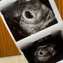 정관에스(S)한의원 이미지