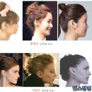 유일렌즈 이미지