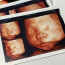 SC제일산부인과의원 | 임신 27주 차 입체초음파 SC제일산부인과 베이비페이스 후기(+배냇짓 영상)