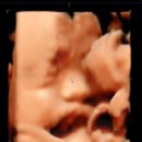 [임신로그_4D입체초음파] 28W6D | 입체초음파 | 피검결과 | 챗지피티 아기 실물 사진 만들기 | 서울시...
