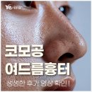 호산한의원 | 코모공여드름흉터, 선정릉역 한의원에서는 어떻게 없앨까? (+후기)