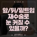Q. 앞, 밑, 뒤트임 재수술하면 눈 더 커질 수 있나요? by. 논현성형외과