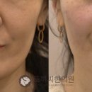 토끼씨한의원 네이버블로그