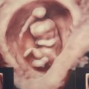 구 진해요항부 병원 | [임신 초기 5주~11주] 산전검사부터 임신 확인, 초음파, 태명 정하기