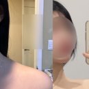 논현신경과의원 | 논현역 의원 초음파 보톡스 &amp; 파셀라 고주파 리프팅 후기! 승모근 보톡스 효과는?