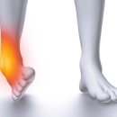 기운찬한방병원 | 겨울철 발목골절 회복기간과 회복 흐름: 붓기·통증이 오래가는 이유