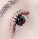 예쁜EYE 이미지