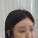 다연헤어라인 이미지