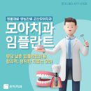 미조프라자 | 군산 임플란트, 실패하는 진짜 이유는? 원인별 예방법 완전 정리