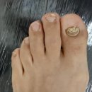 레푸스 앤 두두네일 이미지