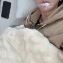 대구 입술 필러 잘하는 곳 추천 내돈내산 솔직 후기(볼륨 입술, 가로 확장)