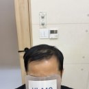 (주)코리아세븐 창원라큐비점 | [하이모 착용후기]남자 포인트백모 부분가발