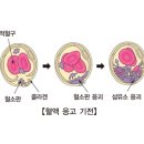 내로