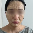 연세보드미의원 네이버블로그