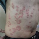 소문생생한의원 이미지