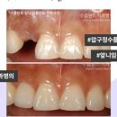 수플란트치과의원 이미지