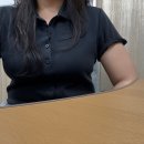 바이오큐 | 팔뚝지방흡입 한달차 리얼후기! 팔뚝, 겨드랑이, 부유방, 견갑까지 총 4400cc 뽑고왔어요!