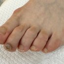 치유네일레푸스 강릉교동점 이미지