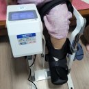 엠플러스병원 | 무릎cpm대여 용인 엠플러스병원 수지구 죽전동 수술 후 집에서 꺾기 재활임대 시피엠기계렌탈