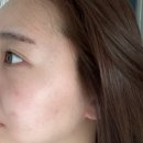 꽃담뷰티 | 성남 모란 피부관리잘하는곳 '꽃담뷰티' 여드름 숨결케어 후기