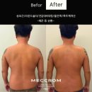 (주)코리아세븐 압구정로데오현대점 | [다니에르 리뷰] 청담동 피부관리 매끄롬 압구정점 남성바디관리 후기