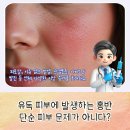 참내과의원 | 루푸스출산 전후로 세심한 건강 관리가 필요한 이유