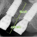 위즈치과기공소 네이버블로그