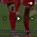 RE:축구-손흥민과 황희찬의 무릎과 부목된다리의 멍들 이미지