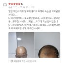 속눈썹 영양제 후기 이미지