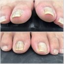 소원장 | 시흥 능곡동 내성발톱 관리로 편안함 찾아주는 뷰티업라이프 뷰티제작소 시흥장현점