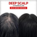 오직 스칼프 이미지