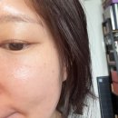 관양동-2 | 관양동 슈링크 잘하는 곳에서 슈링크 유니버스, 토닝레이저 후기