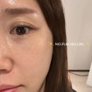 세일약품 | 동화약품 부채표 후시다인 크림 트러블에 굿