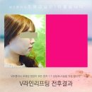 여우라인 이미지