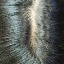 탈모야안녕 | 탈모샴푸 추천 탈모인이 정착한 추천템 후기