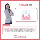 죽전아름다운치과의원 | 잇몸질환 종류와 단계별 증상 정리 죽전 치과