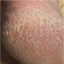 연화제 | 각질연화제 내돈내산 후기 급하신분 보세요