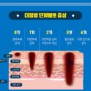 초기 대장암1기 증상부터 말기까지 대장내시경이 필요한 이유 이미지