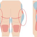 스펀지성형외과의원 이미지